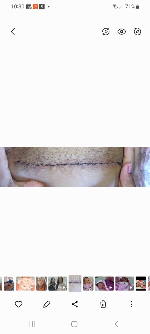 Screenshot_20250106_103046_Gallery Dificuldade financeira por doença