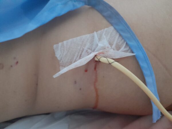 Sua ajuda é a minha esperança: Campanha para salvar o meu rim esquerdo.