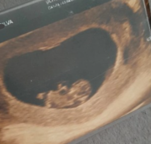 Ajuda com fraldas e itens para meu bebê MENINA